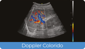 Sistema de Diagnóstico por Ultrassom Acclarix AX3 Innocare.DR - Doppler Colorido
