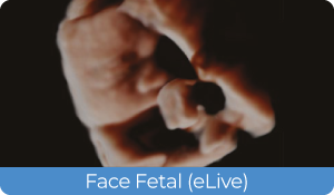 Sistema de Diagnóstico por Ultrassom Acclarix AX3 Innocare.DR - Face Fetal