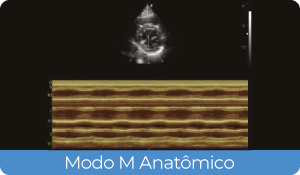 Sistema de Diagnóstico por Ultrassom Acclarix AX3 Innocare.DR - Modo M Anatômico