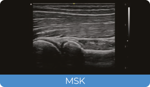 Sistema de Diagnóstico por Ultrassom Acclarix AX3 Innocare.DR - MSK