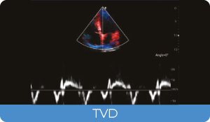 Sistema de Diagnóstico por Ultrassom Acclarix AX3 Innocare.DR - TVD