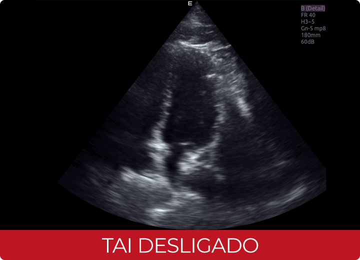 Sistema de Diagnóstico por Ultrassom Acclarix AX8 Innocare.DR - TAI Desligado