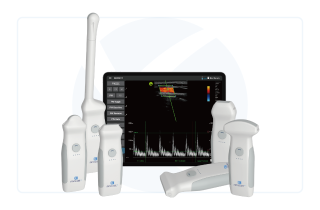 Ultrassom Ultra Portátil