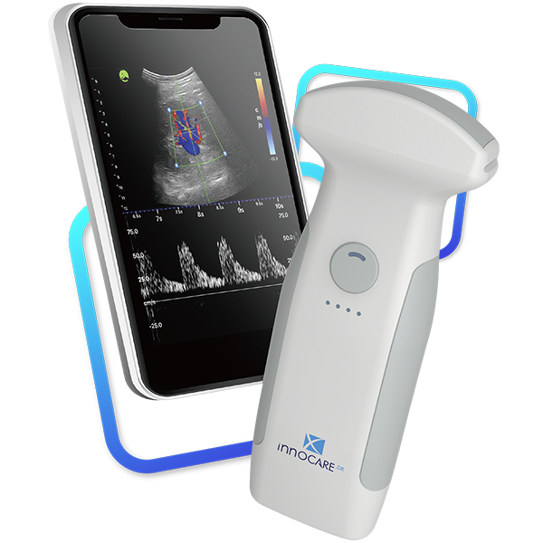 Ultrassons Ultra Portáteis Innocare.DR